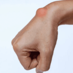 Como remover super bonder dos dedos de um jeito super fácil