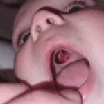 Oito sinais de Pré-Diabetes que requerem muita atenção