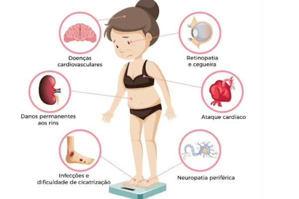 Sinais de pré-diabetes que requerem muita atenção - Imagem via Redes Sociais