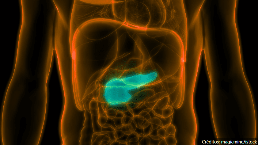 Sintomas do Câncer de Pâncreas - Créditos iStock/Getty Images