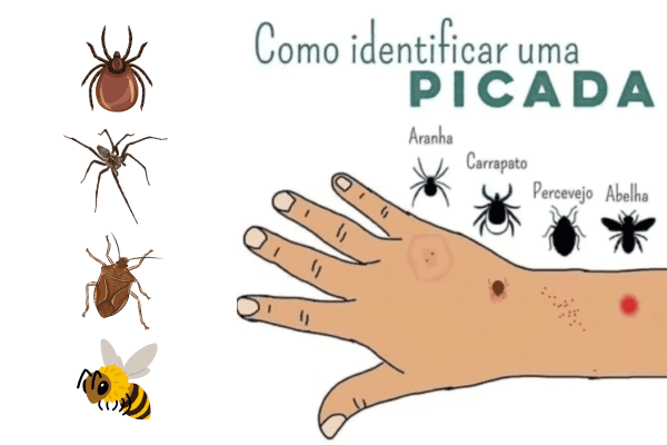 Como identificar picadas de insetos - Imagem via Redes Sociais