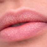 Coceira à noite: o que pode causar, quando é comum e quando merece atenção